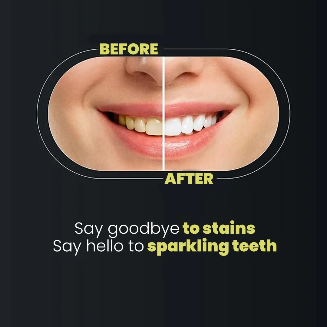 Teeth Whitening Strips 9D Advanced Professional Stain Removing Enamel Safe – image 3