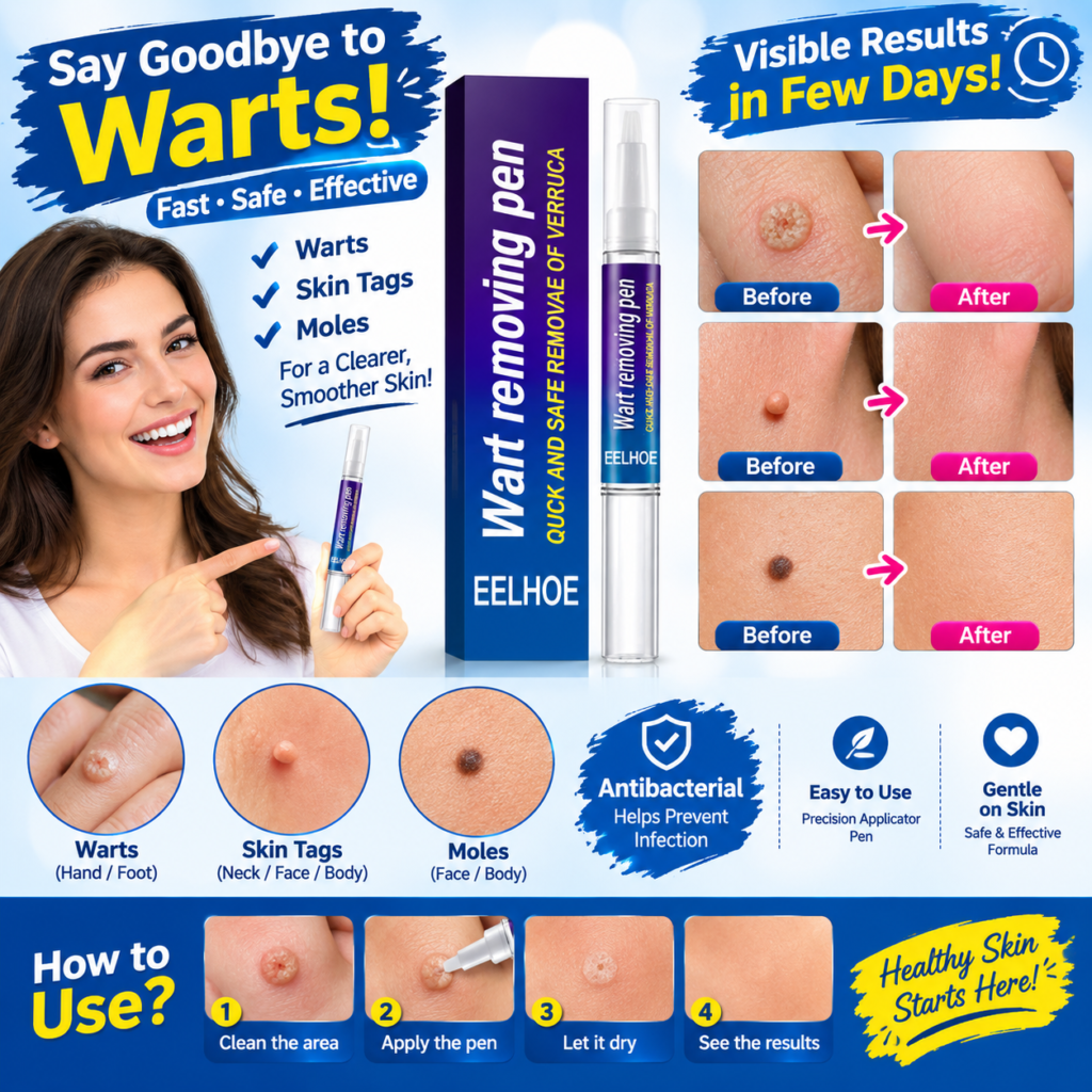 Wart Remover Gel Pen – Powerful Wart Removal Treatment for Hands