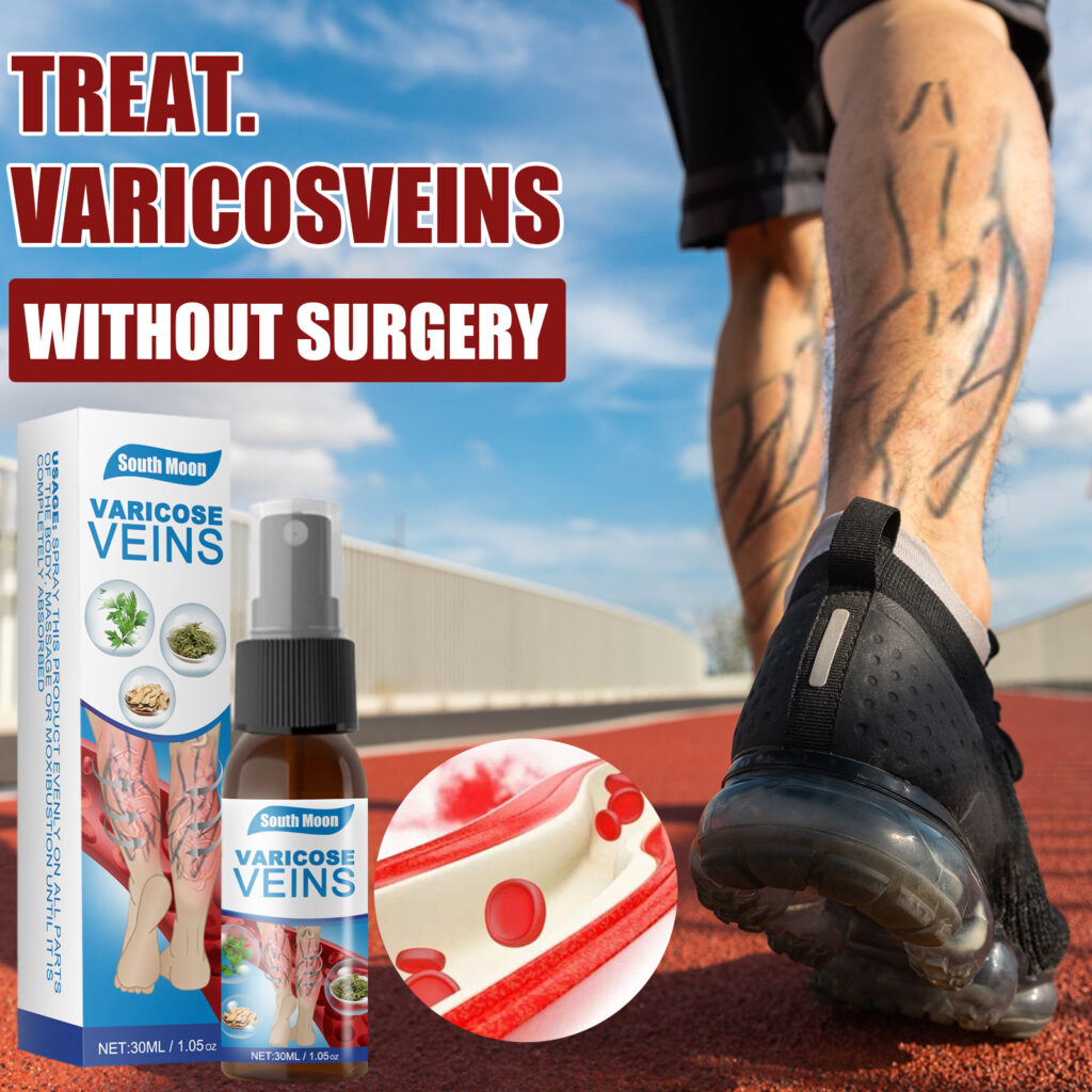 30ml Varicose Veins Treatment Spray Varicose Vein Treatment Cream Repair