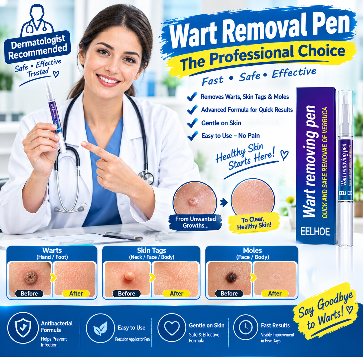 Wart Remover Gel Pen – Powerful Wart Removal Treatment for Hands – image 2