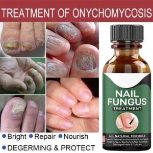 Nail Fungus Treatment Gel – Nail Repair Serum