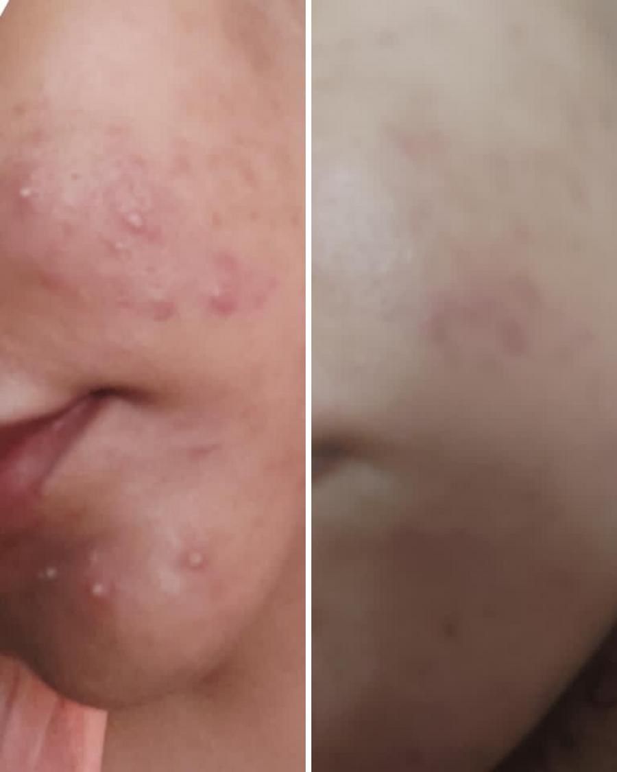 Nirvana Botanics- Vitamin C & E Serum 15ml – image 3